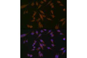 Immunofluorescence analysis of HeLa cells using P Rabbit mAb (ABIN1682842, ABIN3019312, ABIN3019313 and ABIN7101749) at dilution of 1:100 (40x lens). (PAWR antibody)