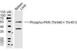 Mouse spleen and liver lysates probed with PKR(Thr446+Thr451) Polyclonal Antibody, unconjugated  at 1:300 overnight at 4°C followed by a conjugated secondary antibody at 1:10000 for 90 minutes at 37°C. (EIF2AK2 antibody  (pThr446, pThr451))