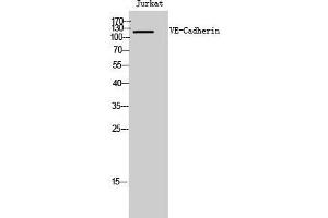 Western Blot (WB) analysis of Jurkat cells using VE-Cadherin Polyclonal Antibody. (Cadherin 5 antibody  (Ser225))