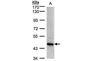 ZBTB24 Antikörper  (C-Term)