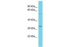 Host: Rabbit Target Name: OR7A5 Sample Type: Jurkat Whole Cell lysates Antibody Dilution: 1. (OR7A5 antibody  (C-Term))