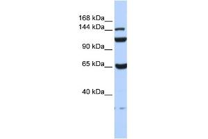 WB Suggested Anti-C17orf57 Antibody Titration: 0. (C17orf57 antibody  (N-Term))