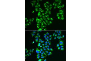 Immunofluorescence analysis of A549 cells using GLUD2 antibody (ABIN5973969). (GLUD2 antibody)