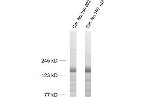 dilution: 1 : 1000, sample: rat brain homogenate (LIPA3 antibody  (AA 313-461))