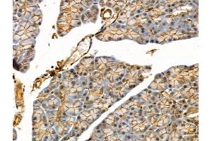 Phospho-eIF4B (Ser504) Antibody at 1/100 staining Rat muscle tissue by IHC-P.