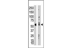 Western blot analysis of TRDMT1 polyclonal antibody  in Jurkat cell lysate (Lane A) and mouse liver tissue lysate (Lane B) . (Dnmt2 antibody  (AA 353-383))