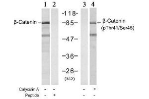 Image no. 1 for anti-Catenin (Cadherin-Associated Protein), beta 1, 88kDa (CTNNB1) (Ser45), (Thr41) antibody (ABIN197275) (CTNNB1 antibody  (Ser45, Thr41))