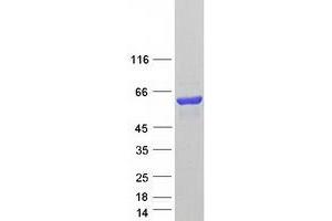 Validation with Western Blot