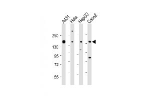 All lanes : Anti-CCK4 (PTK7) Antibody (N-term) at 1:1000-1:2000 dilution Lane 1: A431 whole cell lysate Lane 2: Hela whole cell lysate Lane 3: HepG2 whole cell lysate Lane 4: Caco2 whole cell lysate Lysates/proteins at 20 μg per lane. (PTK7 antibody  (N-Term))