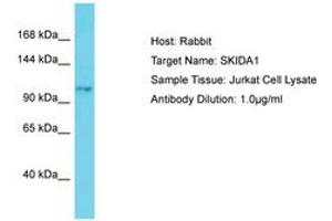 Image no. 1 for anti-SKI/DACH Domain Containing 1 (SKIDA1) (AA 772-821) antibody (ABIN6750805) (SKIDA1 antibody  (AA 772-821))