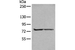 Western blot analysis of A549 and Jurkat cell lysates using ALKBH8 Polyclonal Antibody at dilution of 1:300 (ALKBH8 antibody)