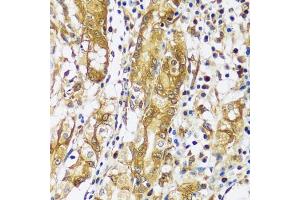 Immunohistochemistry of paraffin-embedded human stomach using CAST antibody  at dilution of 1:100 (40x lens). (Calpastatin antibody  (AA 1-350))