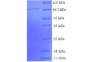 SDS-PAGE (SDS) image for Phosphoglycerate Kinase 1 (PGK1) (AA 25-417), (partial) protein (GST tag) (ABIN5712027)