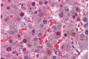 Human Liver: Formalin-Fixed, Paraffin-Embedded (FFPE) (IDH1 antibody  (C-Term))