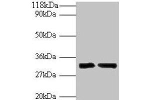 Western blot All lanes: IL-33 antibody at 2 μg/mL Lane 1: Hela whole cell lysate Lane 2: Mouse lung tissue Secondary Goat polyclonal to rabbit IgG at 1/10000 dilution Predicted band size: 32 kDa Observed band size: 32 kDa (IL-33 antibody  (AA 123-276))