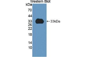 Detection of Recombinant CYP1A2, Rat using Polyclonal Antibody to Cytochrome P450 1A2 (CYP1A2) (CYP1A2 antibody  (AA 192-444))