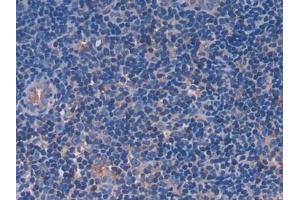 Detection of FGL1 in Rat Lymph node Tissue using Polyclonal Antibody to Fibrinogen Like Protein 1 (FGL1) (FGL1 antibody  (AA 23-314))