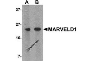 Western Blotting (WB) image for anti-MARVEL Domain Containing 1 (MARVELD1) (N-Term) antibody (ABIN1031451)