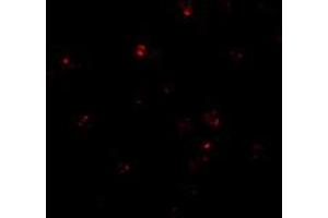 Immunofluorescence of PSENEN in K-562 cells with PSENEN polyclonal antibody  at 20 ug/mL . (PEN2 antibody  (C-Term))