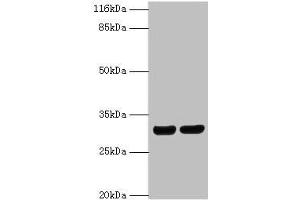 Western blot All lanes: HLA-DRB1 antibody at 2 μg/mL Lane 1: A375 whole cell lysate Lane 2: Raji whole cell lysate Secondary Goat polyclonal to rabbit IgG at 1/10000 dilution Predicted band size: 30 kDa Observed band size: 30 kDa (HLA-DRB1 antibody  (AA 30-266))