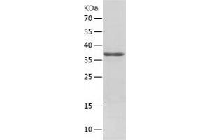 Western Blotting (WB) image for Apurinic/Apyrimidinic Endonuclease 1 (APEX1) (AA 1-318) protein (His tag) (ABIN7285814) (APEX1 Protein (AA 1-318) (His tag))