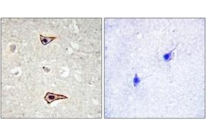 Immunohistochemistry analysis of paraffin-embedded human brain, using Kv1. (KCNA3 antibody  (pTyr135))