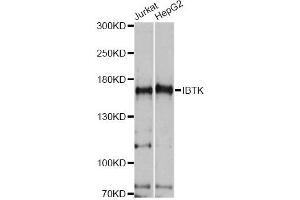 Western blot analysis of extracts of various cell lines, using IBTK antibody. (IBTK antibody)