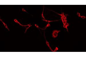 ABIN6266565 staining Hela by IF/ICC. (Integrin beta 5 antibody  (C-Term))