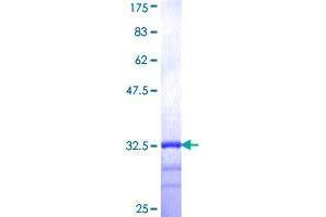 AGTRAP Protein (AA 108-159) (GST tag)