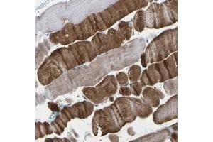 Immunohistochemical staining of human skeletal muscle with TMCO4 polyclonal antibody  shows strong cytoplasmic positivity in myocytes at 1:200-1:500 dilution. (TMCO4 antibody)