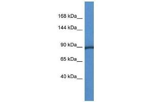 Western Blot showing Pygm antibody used at a concentration of 1. (PYGM antibody  (C-Term))