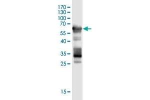 Western Blot detection against Immunogen (59. (SCML4 antibody  (AA 1-305))