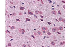 Immunohistochemistry (IHC) image for anti-T-Box Brain Gene 1 (TBR1) (N-Term) antibody (ABIN2779899) (TBR1 antibody  (N-Term))