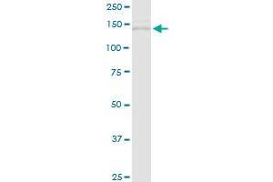 TIMELESS MaxPab rabbit polyclonal antibody. (TIMELESS antibody  (AA 1-1208))