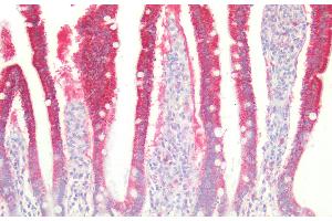 Detection of MST in Human Small intestine Tissue using Polyclonal Antibody to 3-Mercaptopyruvate Sulfurtransferase (MST) (MPST antibody  (AA 68-278))