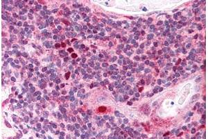 Human Thymus (formalin-fixed, paraffin-embedded) stained with AIRE antibody ABIN291034 at 2. (AIRE antibody  (AA 534-545))
