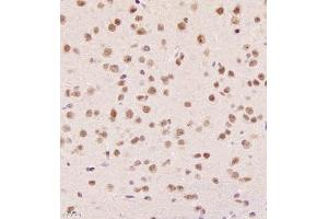 Immunohistochemistry of paraffin embedded mouse brain using SR140 (ABIN7076091) at dilution of 1:1000 (400x lens) (SR140 antibody)