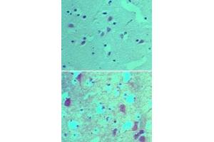 Image no. 1 for anti-SRY (Sex Determining Region Y)-Box 1 (SOX1) (AA 100-150) antibody (ABIN960348) (SOX1 antibody  (AA 100-150))