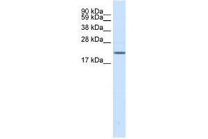 WB Suggested Anti-SCN3B Antibody Titration: 0. (SCN3B antibody  (N-Term))