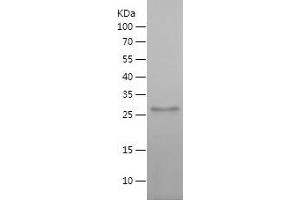 VPS52 Protein (AA 11-170) (His tag)