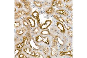 Immunohistochemistry (IHC) image for anti-Kallikrein 1 (KLK1) (AA 25-262) antibody (ABIN3022582)