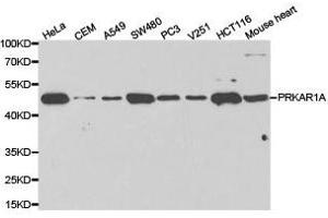 Western Blotting (WB) image for anti-Protein Kinase, CAMP-Dependent, Regulatory, Type I, alpha (Tissue Specific Extinguisher 1) (PRKAR1A) antibody (ABIN1874285) (PRKAR1A antibody)