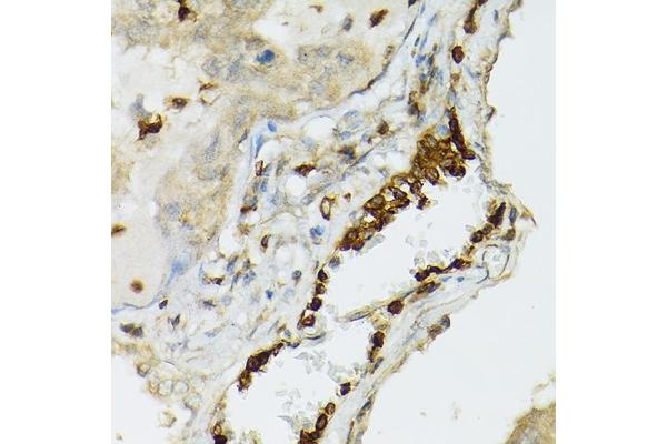 TLR1 antibody  (AA 30-290)