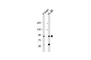 All lanes : Anti-CCDC144A Antibody (C-Term) at 1:2000 dilution Lane 1: human brain lysate Lane 2: HL-60 whole cell lysate Lysates/proteins at 20 μg per lane. (CCDC144A antibody  (AA 1257-1289))