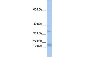 WB Suggested Anti-SF3B14 Antibody Titration:  0.