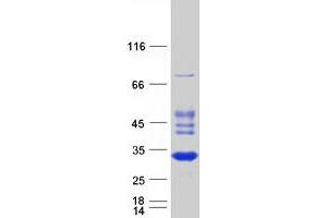 Western Blotting (WB) image for RAB, Member of RAS Oncogene Family-Like 2A (RABL2A) (Transcript Variant 2) protein (Myc-DYKDDDDK Tag) (ABIN2730387)
