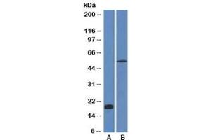 Western blot analysis A) partial recombinant protein B) human stomach lysate using E-Cadherin antibody (CDH1/1525). (E-cadherin antibody)