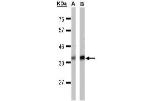 WB Image Sample(30 μg of whole cell lysate) A:MOLT4 , B:Raji , 15% SDS PAGE antibody diluted at 1:1000 (FFAR1 antibody  (C-Term))