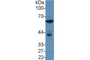 Western blot analysis of Human PC3 cell lysate, using Rat GPI Antibody (3 µg/ml) and HRP-conjugated Goat Anti-Rabbit antibody ( (GPI antibody  (AA 335-558))