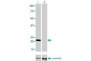 Western blot analysis of MYL1 over-expressed 293 cell line, cotransfected with MYL1 Validated Chimera RNAi (Lane 2) or non-transfected control (Lane 1).
